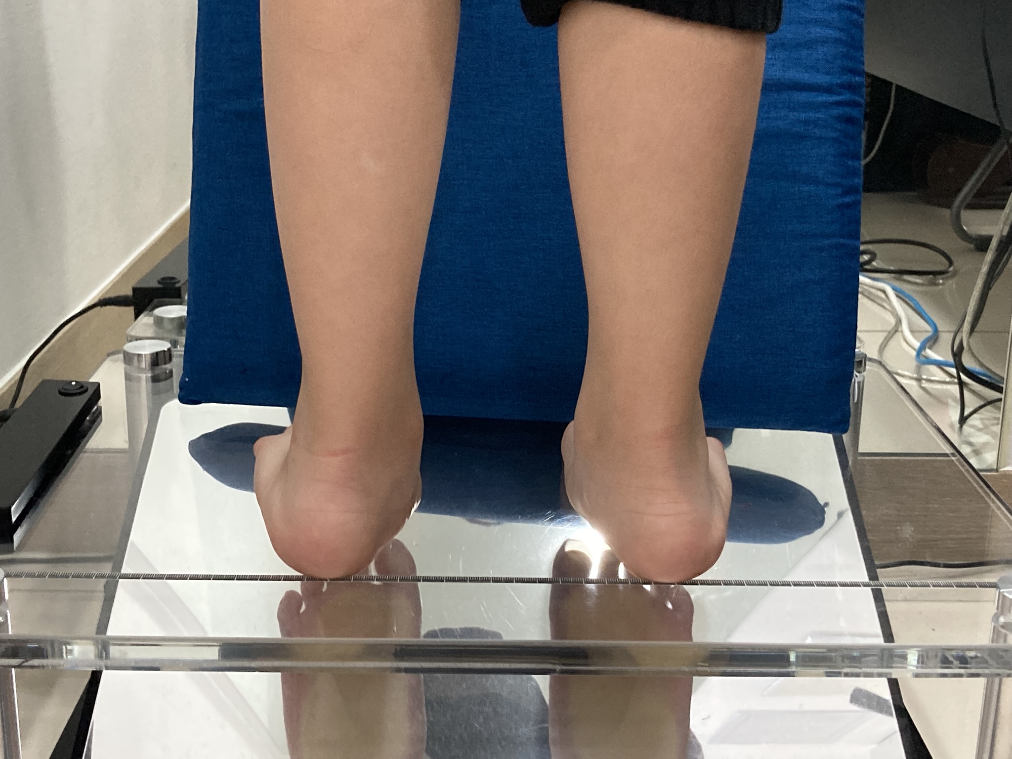평발 검사 시 뒤꿈치·발목 정렬 확인 모습