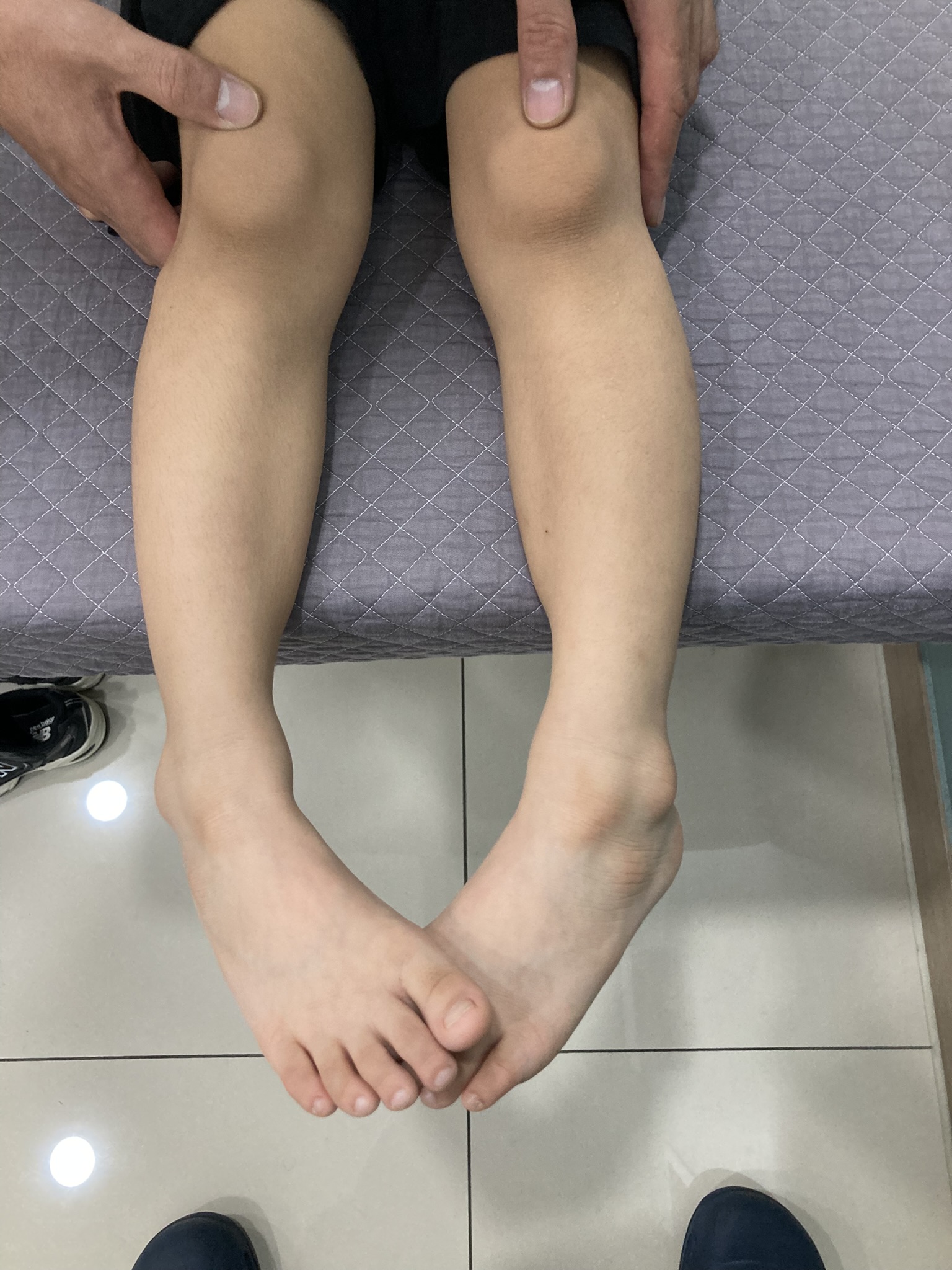 안짱걸음 발끝 방향 확인 모습